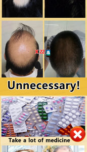 Fastest  Hair Regrowth