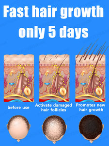 Fastest  Hair Regrowth