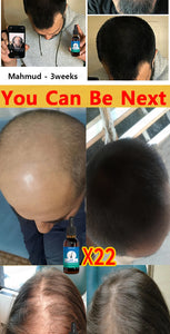 Fastest  Hair Regrowth