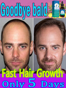 Fastest  Hair Regrowth