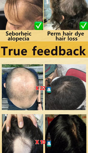 Fastest  Hair Regrowth