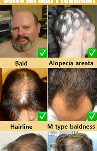 Fastest  Hair Regrowth